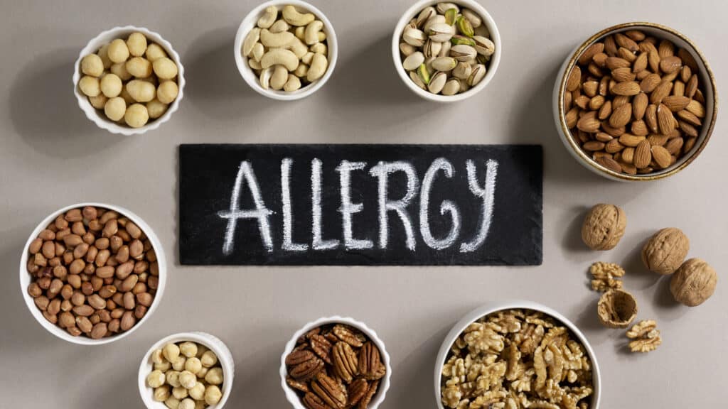 Allspice Allergy Recognizing Symptoms and Managing Reactions natural